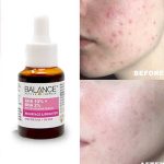 سرم لایه بردار و روشن کننده پیلینگ AHA 10% + BHA 2% بالانس - تصویر 3