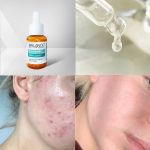 سرم ضدجوش و ضدلک نیاسینامید بالانس - تصویر 4